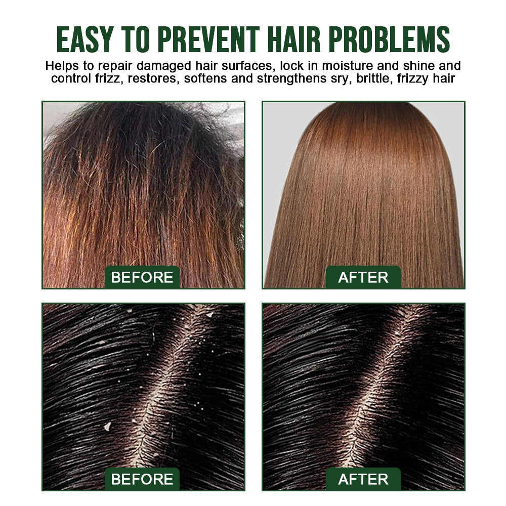 Natural Rosemary Hair Growth Shampoo Bar for Deep Scalp Cleansing