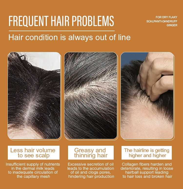 Jan London Ginger Anti-Dandruff Shampoo for Dry Itchy Scalp